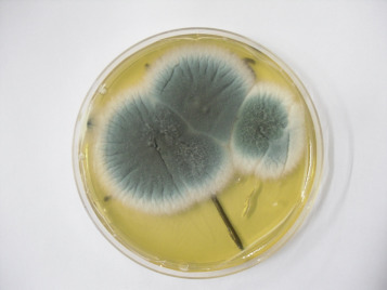 1-s2.0-S1557506315000798-gr4