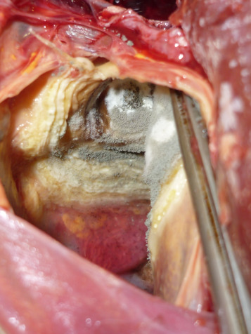 1-s2.0-S1557506315000798-gr5